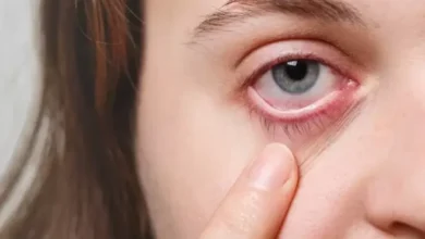 Mengenal Retinopati Diabetik, Penyakti Mata Akibat Diabetes