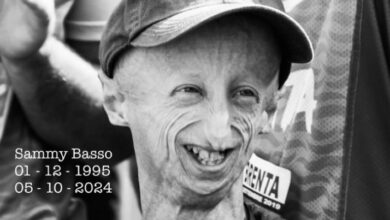 Mengenal Progeria, Penyakit yang mana digunakan Bikin Sammy Basso Alami Penuaan Dini